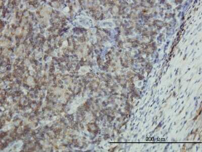 Immunohistochemistry-Paraffin: EMP3 Antibody (3D4) [H00002014-M01]