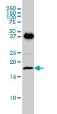 Western Blot: EMP3 Antibody (3D4) [H00002014-M01]