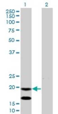 Western Blot: EMP3 Antibody (3D4) [H00002014-M01]