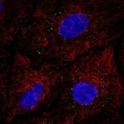 Immunocytochemistry/ Immunofluorescence: EMP3 Antibody [NBP3-17247]