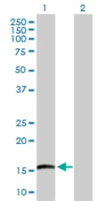 Western Blot: EMP3 Antibody [H00002014-D01P]