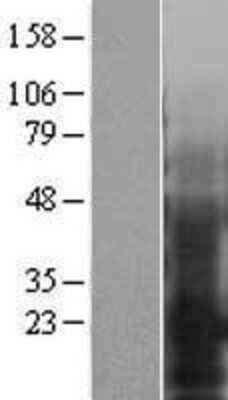 Western Blot: EMP3 Overexpression Lysate [NBL1-10261]