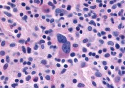 Immunohistochemistry-Paraffin: EMR1 Antibody - BSA Free [NLS2678]