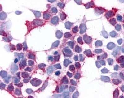 Immunohistochemistry: EMR2 Antibody - BSA Free [NLS1663]