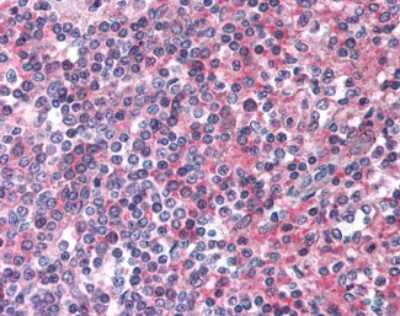 Immunohistochemistry-Paraffin: EMR2 Antibody - BSA Free [NLS1663]