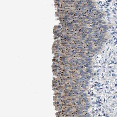 Immunohistochemistry: EMR3 Antibody [NBP1-86454]