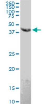 Western Blot: EMR4P Antibody (1G10) [H00326342-M02]