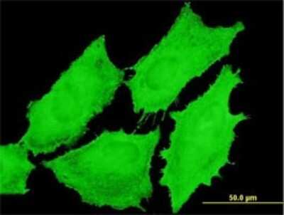 Immunocytochemistry/ Immunofluorescence: EMR4P Antibody (2H8) [H00326342-M01]