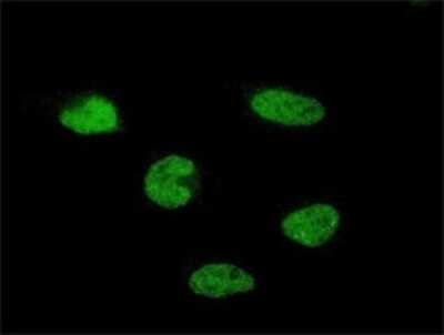 Immunocytochemistry/ Immunofluorescence: EMSY Antibody (5D1) [H00056946-M01]