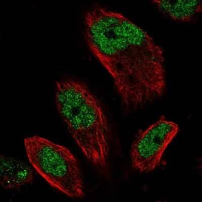 Immunocytochemistry/ Immunofluorescence: EMSY Antibody [NBP2-58469]