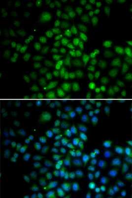 Immunocytochemistry/ Immunofluorescence: EMSY Antibody - BSA Free [NBP3-03288]