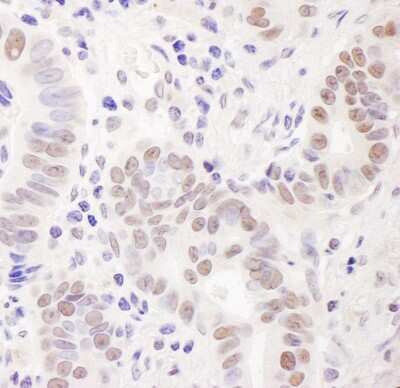 Immunohistochemistry-Paraffin: EMSY Antibody [NB100-545]