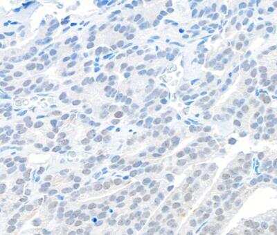 Immunohistochemistry-Paraffin: EMSY Antibody [NB100-545]