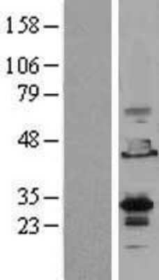 Western Blot: EMX2 Overexpression Lysate [NBL1-10262]