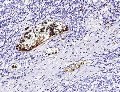 Immunohistochemistry-Paraffin: EN-RAGE/S100A12 Antibody (133) [NBP2-89816]