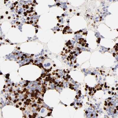 Immunohistochemistry-Paraffin: EN-RAGE/S100A12 Antibody [NBP1-86694]