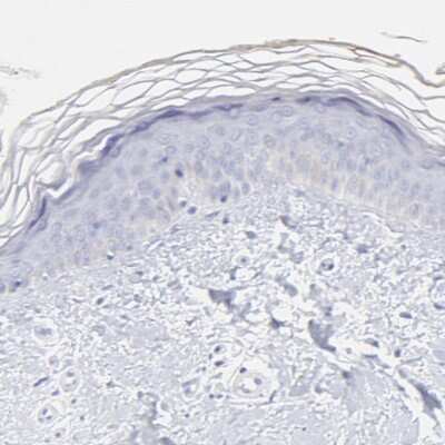 Immunohistochemistry-Paraffin: EN-RAGE/S100A12 Antibody [NBP1-86694]