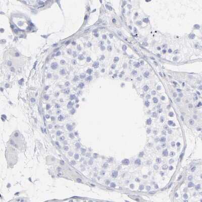 Immunohistochemistry-Paraffin: EN-RAGE/S100A12 Antibody [NBP1-86694]