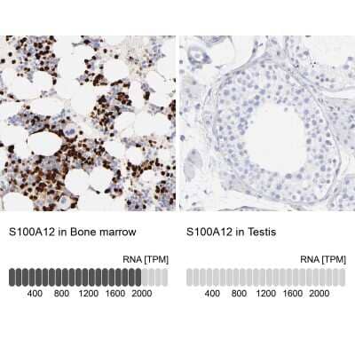 Immunohistochemistry-Paraffin: EN-RAGE/S100A12 Antibody [NBP1-86694]