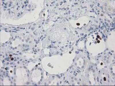 Immunohistochemistry: EN-RAGE/S100A12 Antibody (OTI1D1) - Azide and BSA Free [NBP2-71276]