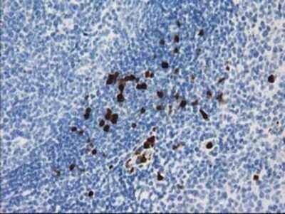 Immunohistochemistry: EN-RAGE/S100A12 Antibody (OTI1D1) - Azide and BSA Free [NBP2-71276]