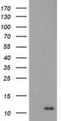 Western Blot: EN-RAGE/S100A12 Antibody (OTI1D1)Azide and BSA Free [NBP2-71276]