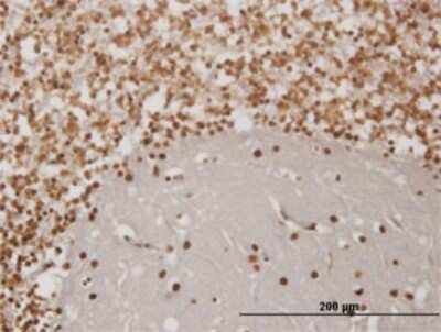 Immunohistochemistry-Paraffin: EN1/Engrailed 1 Antibody (1F5) [H00002019-M06]