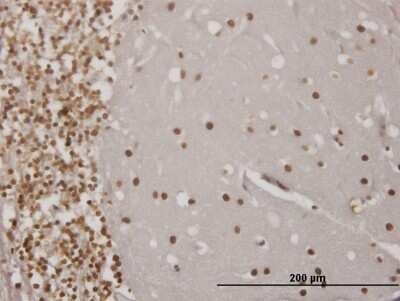 Immunohistochemistry-Paraffin: EN1/Engrailed 1 Antibody (3H2) [H00002019-M04]