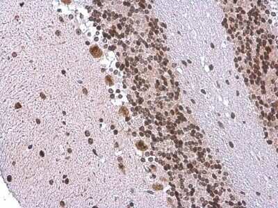 Immunohistochemistry-Paraffin: EN1/Engrailed 1 Antibody [NBP3-13332]