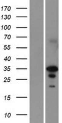 Western Blot: engrailed homeobox 2 Overexpression Lysate [NBP2-08210]