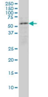 Western Blot: ENC1 Antibody (3B1) [H00008507-M02]