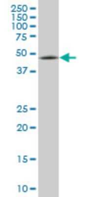 Western Blot: ENC1 Antibody (3C10) [H00008507-M03]