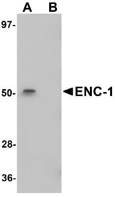 Western Blot: ENC1 AntibodyBSA Free [NBP1-77146]