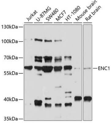 Western Blot: ENC1 AntibodyBSA Free [NBP3-04613]