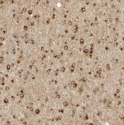 Immunohistochemistry: ENDOD1 Antibody [NBP1-81473]