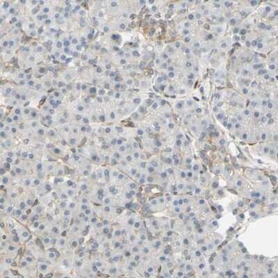 Immunohistochemistry-Paraffin: ENDOD1 Antibody [NBP1-81473]