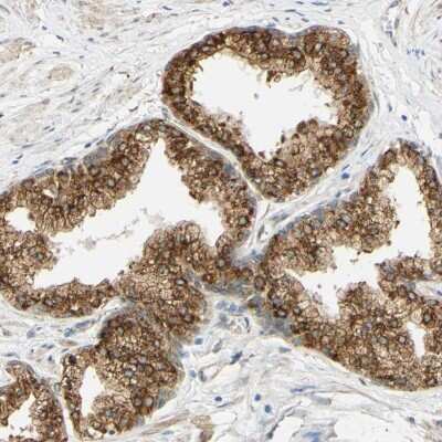 Immunohistochemistry-Paraffin: ENDOD1 Antibody [NBP1-81473]