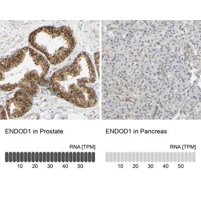 Immunohistochemistry-Paraffin: ENDOD1 Antibody [NBP1-81473]