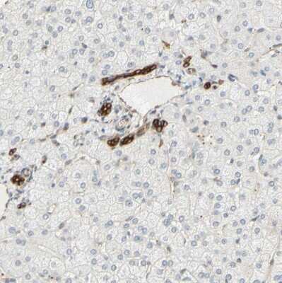 Immunohistochemistry-Paraffin: ENDOD1 Antibody [NBP1-81473]