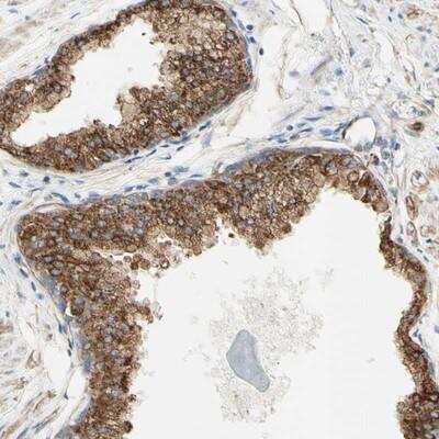 Immunohistochemistry-Paraffin: ENDOD1 Antibody [NBP1-81474]