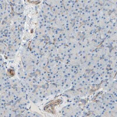 Immunohistochemistry-Paraffin: ENDOD1 Antibody [NBP1-81474]