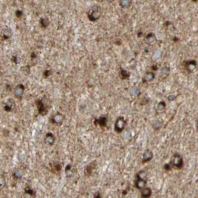 Immunohistochemistry-Paraffin: ENDOD1 Antibody [NBP1-81474]