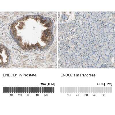 Immunohistochemistry-Paraffin: ENDOD1 Antibody [NBP1-81474]