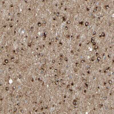 Immunohistochemistry-Paraffin: ENDOD1 Antibody [NBP1-81474]