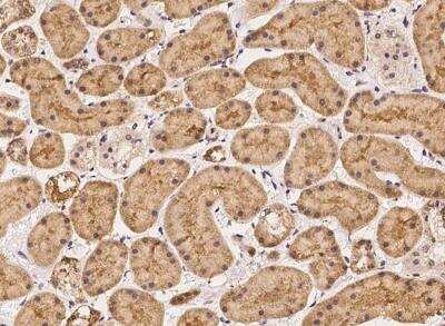 Immunohistochemistry-Paraffin: ENDOD1 Antibody [NBP3-06563]