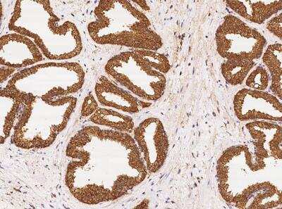 Immunohistochemistry-Paraffin: ENDOD1 Antibody [NBP3-06563]