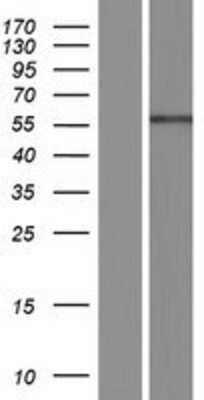 Western Blot: ENDOD1 Overexpression Lysate [NBP2-07224]