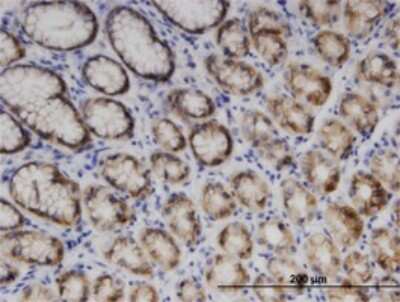 Immunohistochemistry-Paraffin: ENDOGL1 Antibody (2F7) [H00009941-M02]
