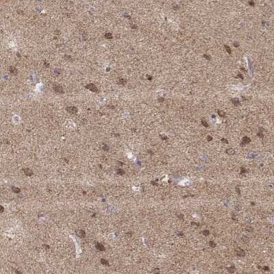 Immunohistochemistry-Paraffin: ENDOGL1 Antibody [NBP2-62597]