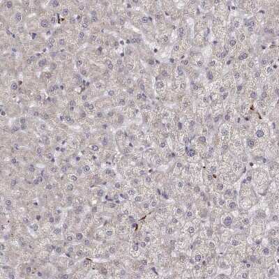 Immunohistochemistry-Paraffin: ENDOGL1 Antibody [NBP2-62597]